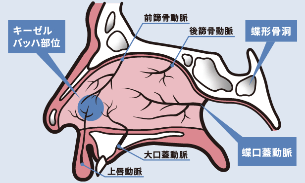 鼻出血について