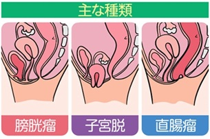 原因は？
