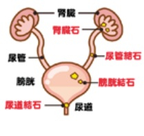 ジェットコースターで石が出る？